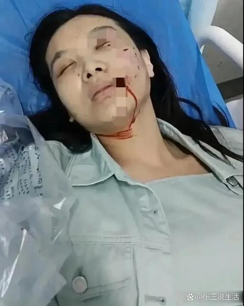新澳天天开奖资料大全正版和女子为4只狗立遗嘱与女子为4只狗立遗嘱视频